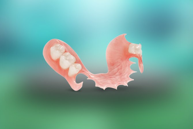 Flexible Removable Partial Dentures