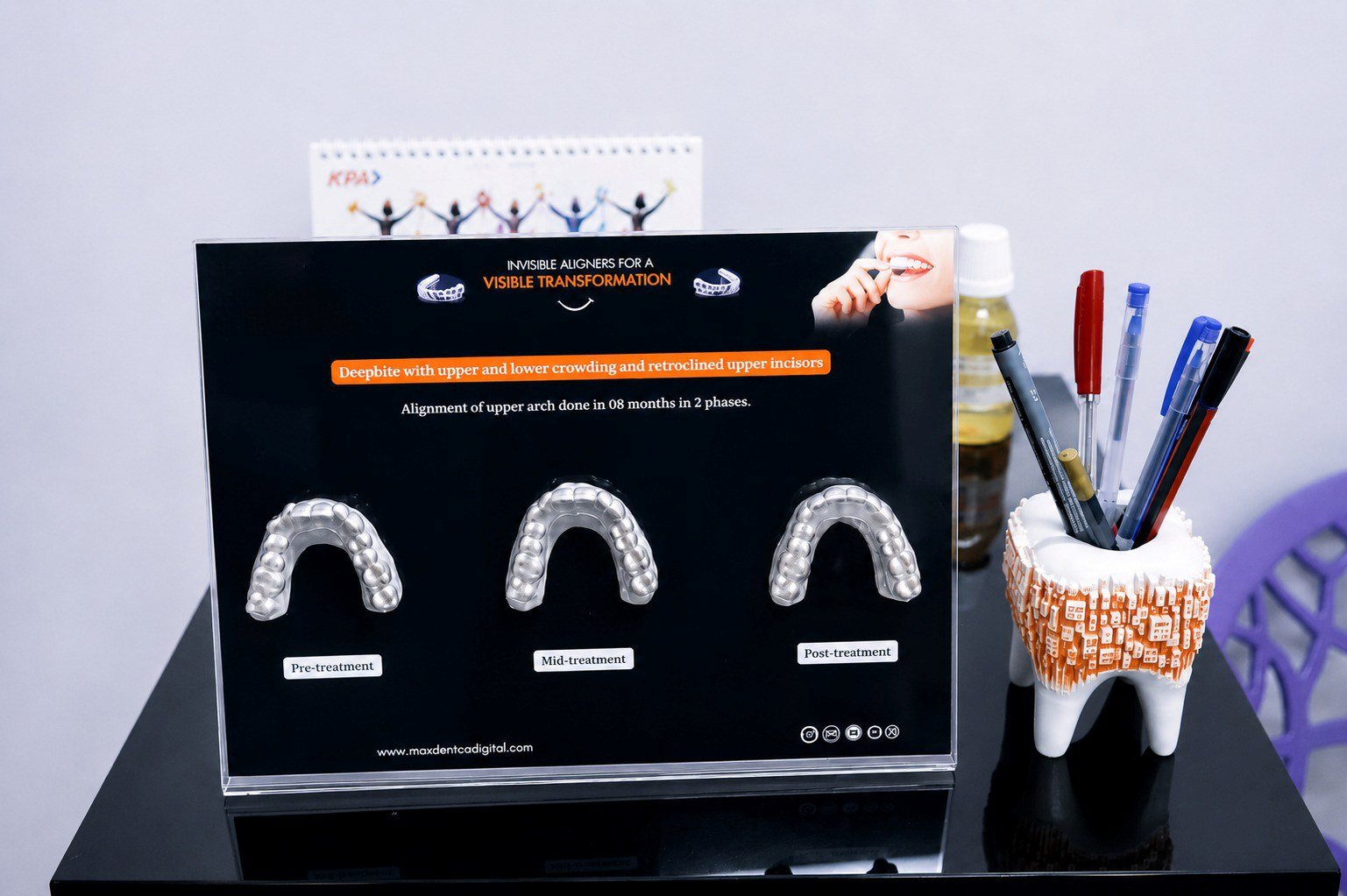 In-House Aligner Lab