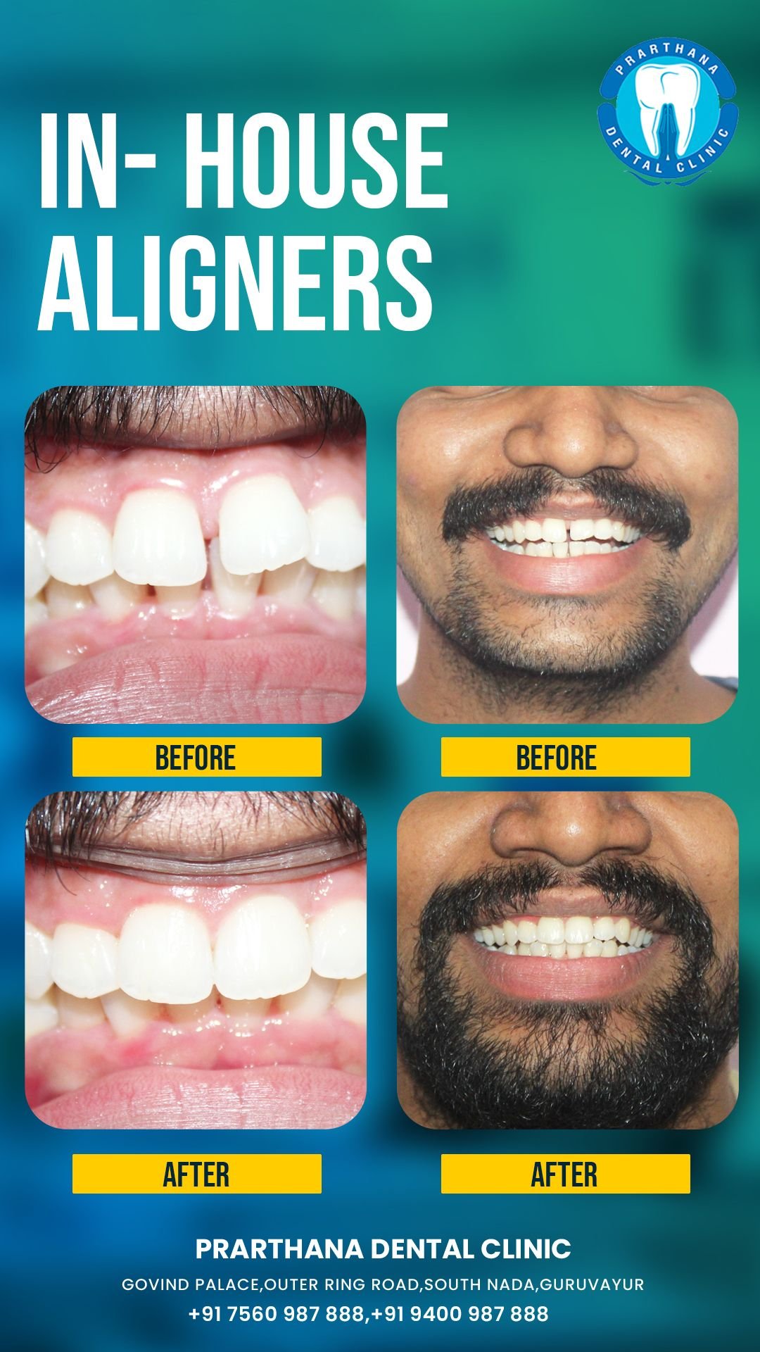 Gap Closure Transformation Case
